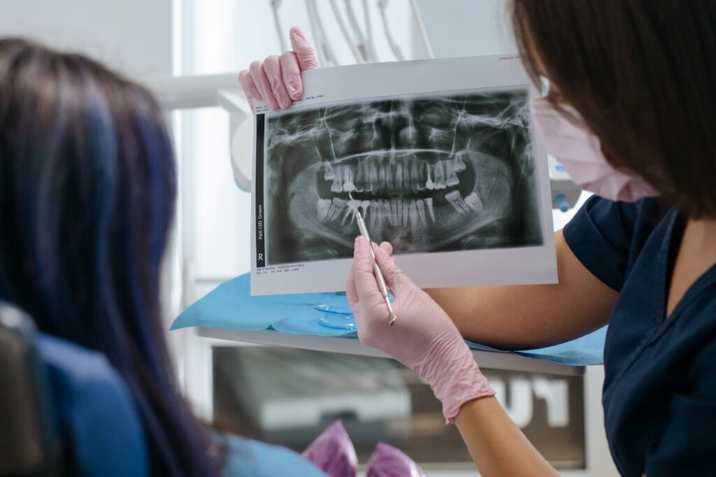 Canals narrow over a lifetime as secondary dentine is laid down