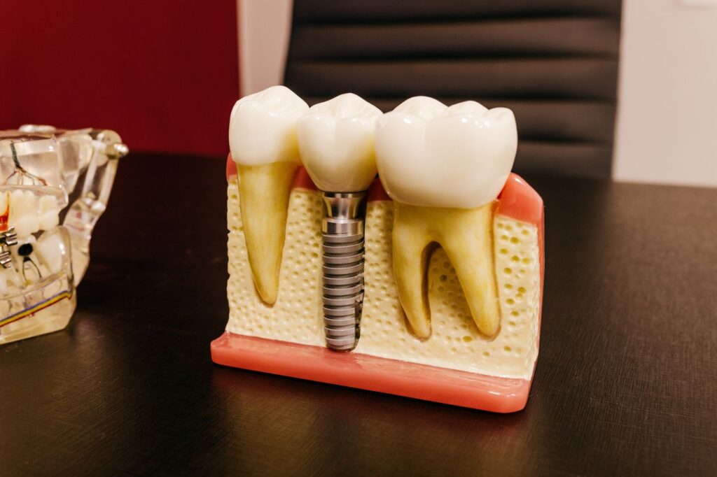 Curvature, calcification and extra canals are the usual referral triggers