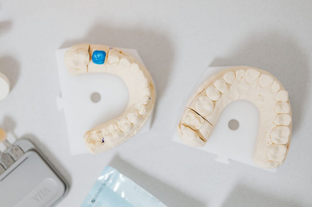 Ceramic crown and bridge models used to replace a missing tooth