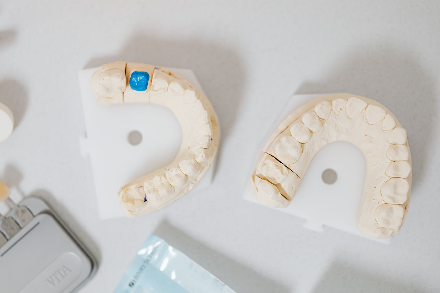 Ceramic crown and bridge models used to replace a missing tooth