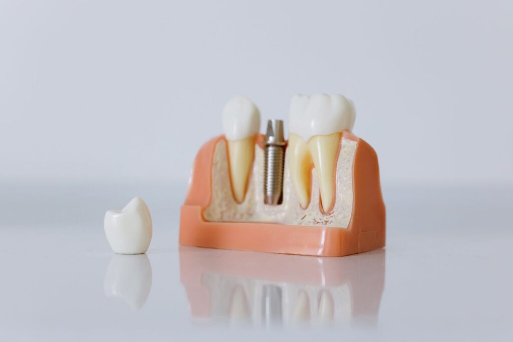 Decades of previous dentistry change how a tooth is accessed