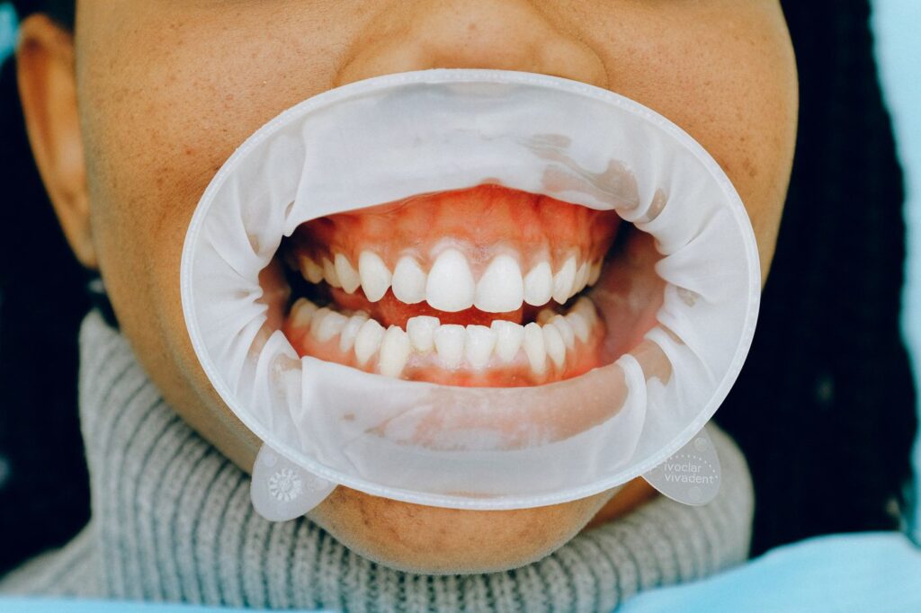 A swelling on the gum can come from the gum or from inside the tooth