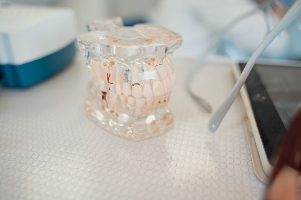 Lower molars are the hardest teeth in the mouth to anaesthetise reliably