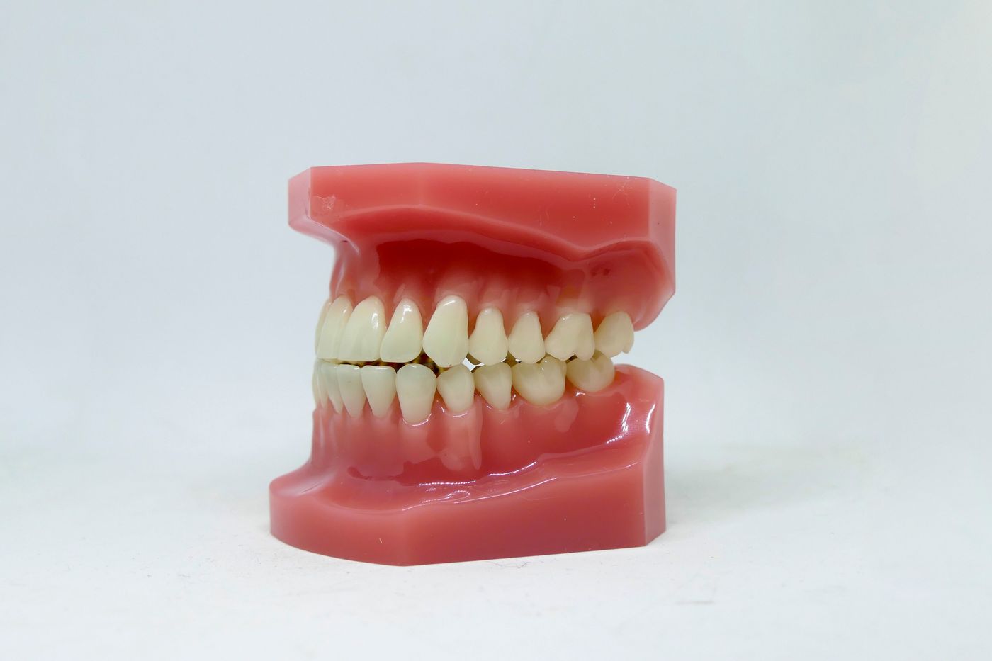 The five crack types are defined by how far the fracture travels