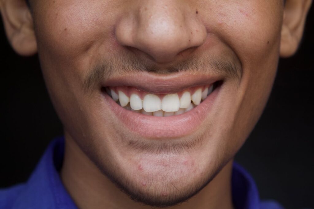 Most previously treated teeth can still be saved