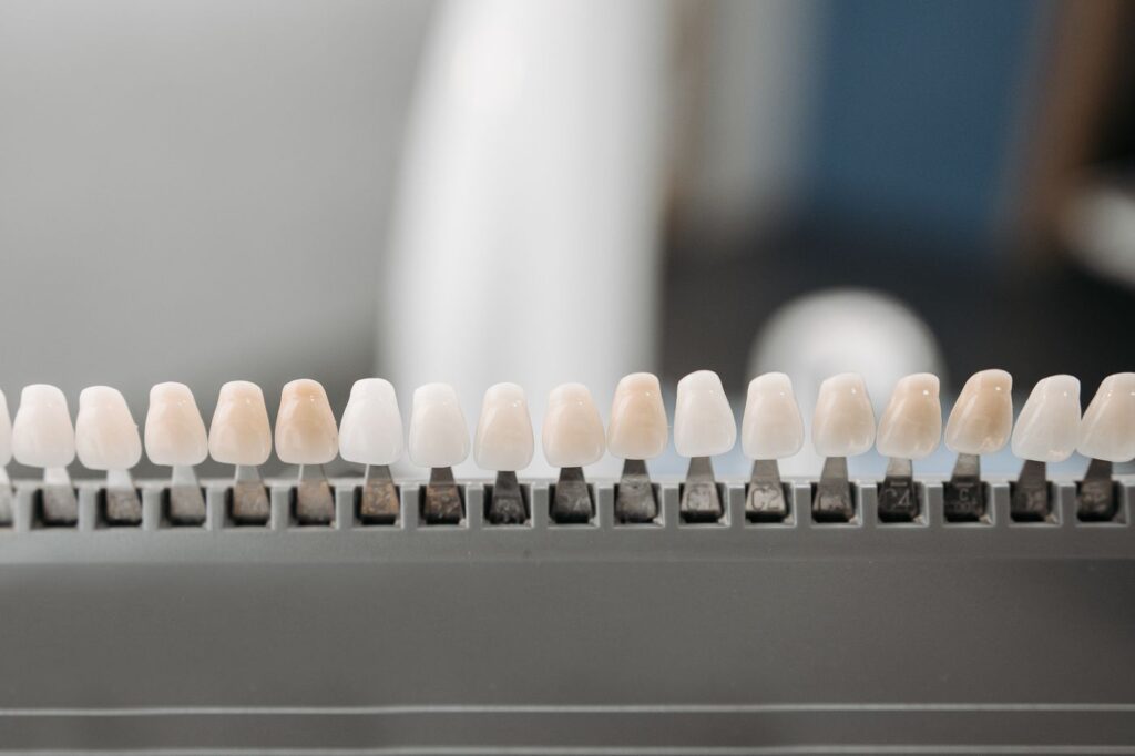 A crown or veneer is the fallback when bleaching does not lift the shade enough